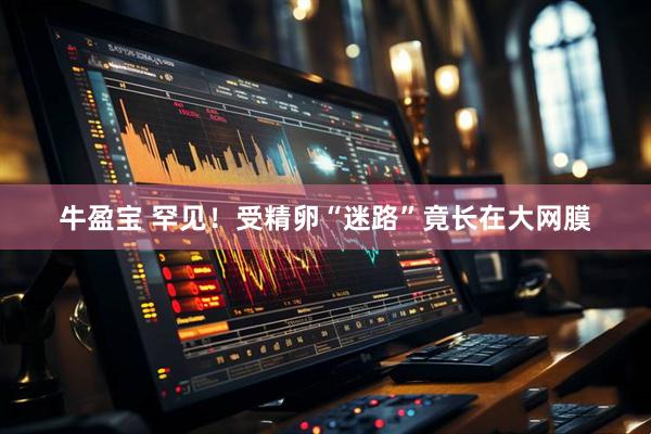 牛盈宝 罕见！受精卵“迷路”竟长在大网膜
